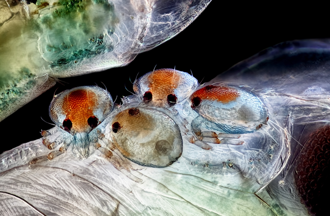 Photographing the Microscopic Winners of Nikon Small World 2015_13